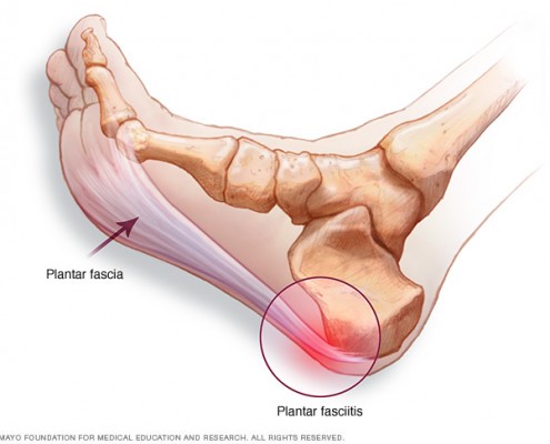 plantar fascia